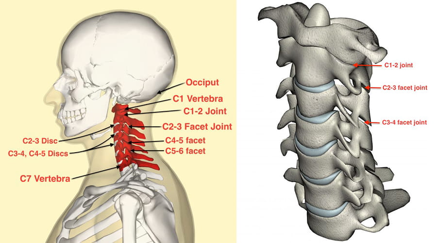 Headache And Migraine Treatment