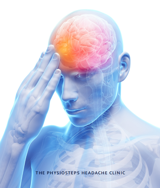 The Physiosteps Headache Clinic | The Lasting Solution to Headaches